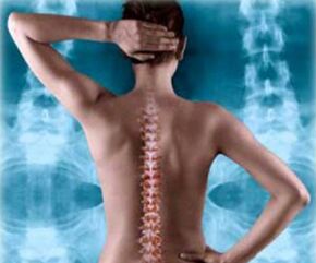 ilustração da coluna traseira