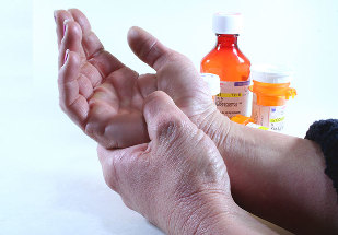 métodos de tratamento de artrite e artrose