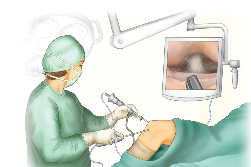 Cirurgia no joelho