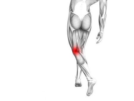 Osteoartrite da articulação do joelho