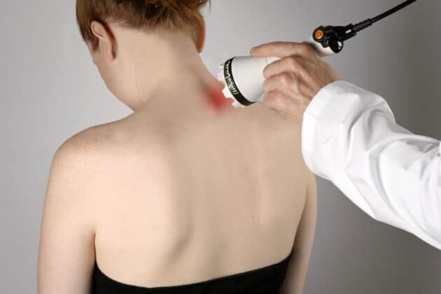 A terapia a laser é usada para combater a dor nas costas na área da omoplata. 