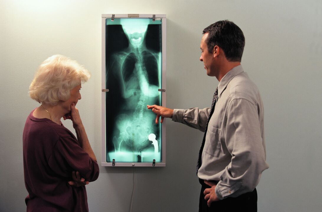 diagnóstico de raio-x para dor na articulação do quadril