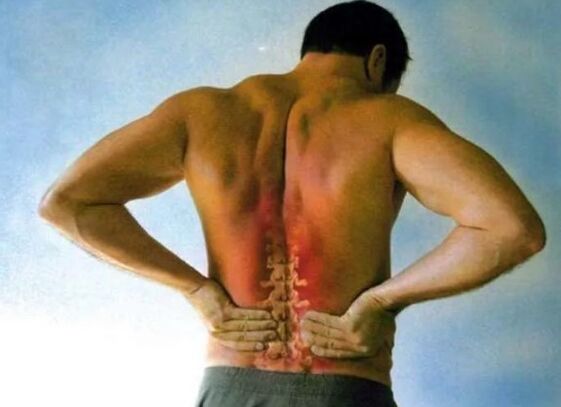 Dor para osteocondrose lombar